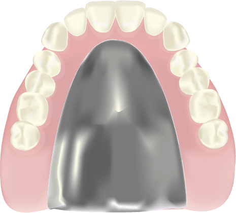 金属床義歯（チタン・コバルトコロム材）